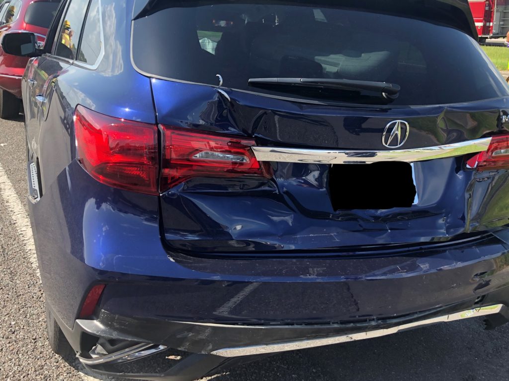 2018 Acura MDX